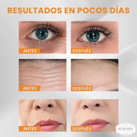 BEAUTYPATCH™ - REVITALIZA TU PIEL EN 7 DÍAS